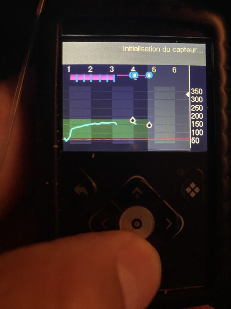 La courbe est constituée de points(glycémie) toutes les 5 minutes. Ici c'est en cours d'initialisation.Sommeil interrompu.